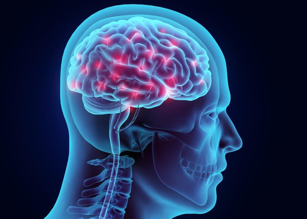 Risk Assessment Of Brain Hemorrhages